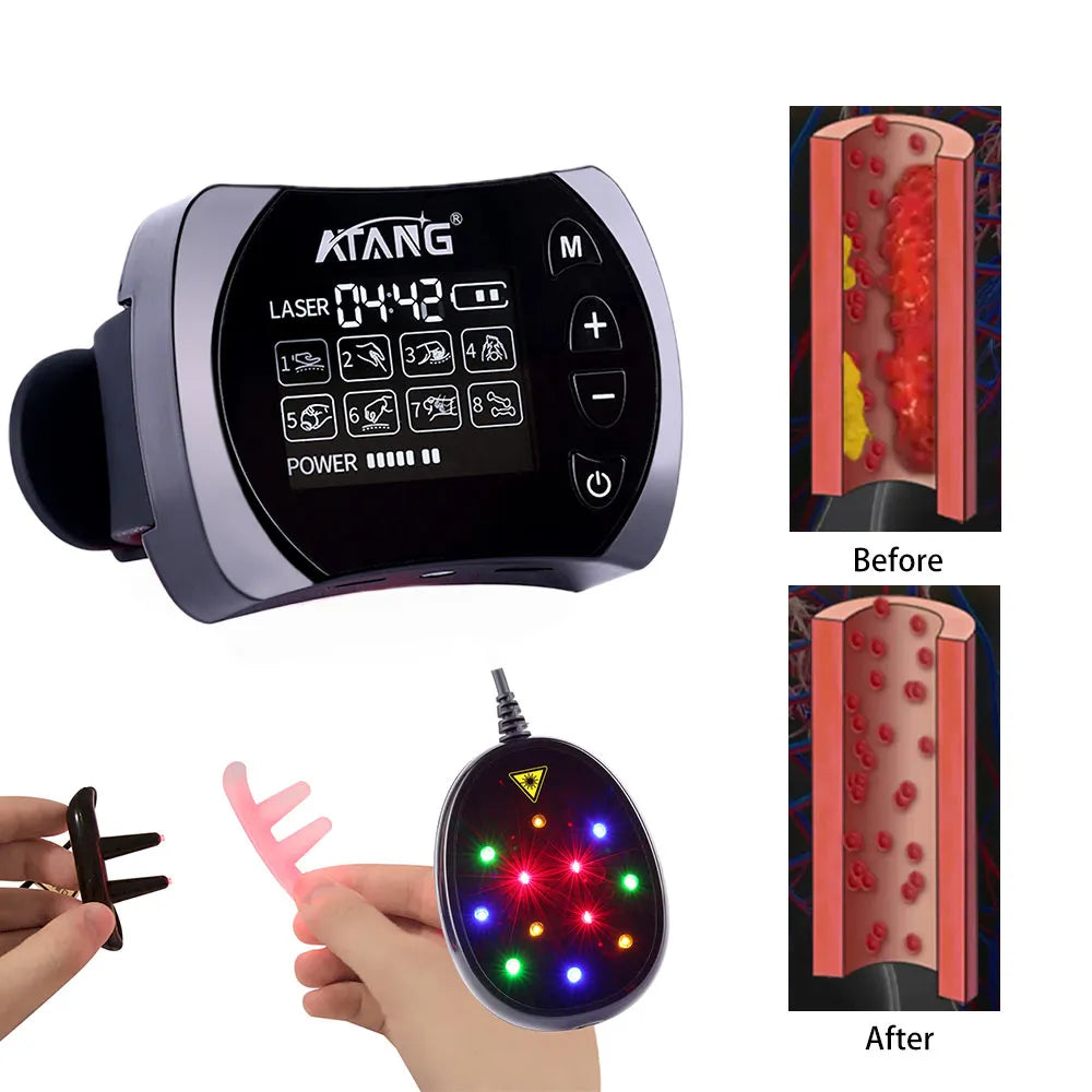 Multifunction Wrist Watch Pain Relief Rhinitis Pharyngitis Diabetes Hypertension Full Accessories Laser Therapy EMS PAD  Device